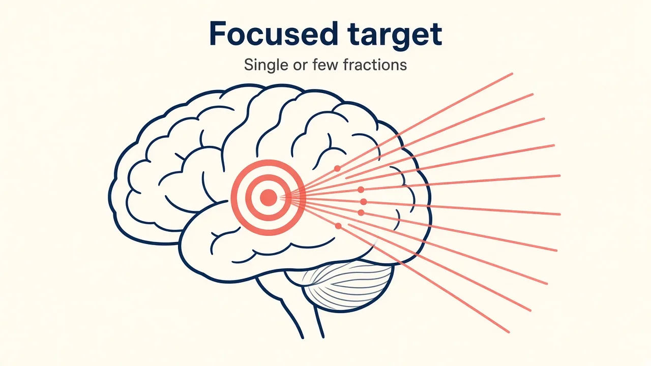 Illustration of many radiation beams meeting at a small intracranial target