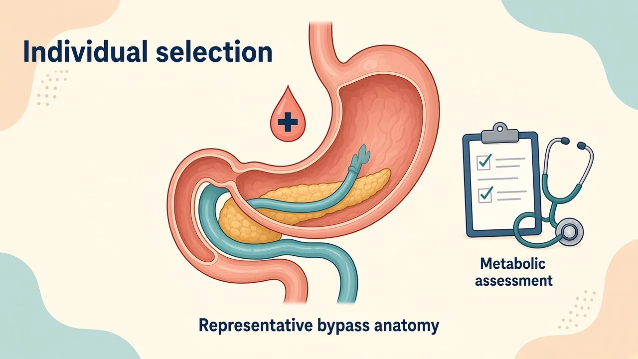Medical illustration comparing sleeve and bypass gastrointestinal anatomy considered within individualized type 2 diabetes care