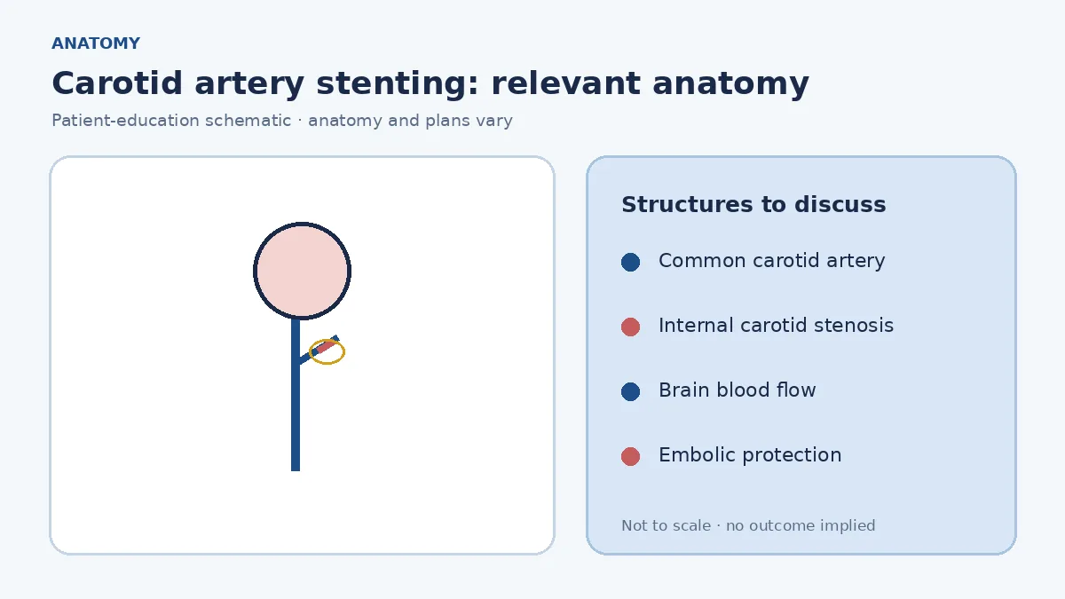 Medical illustration of a narrowed internal carotid artery in the neck and its relationship to brain blood flow