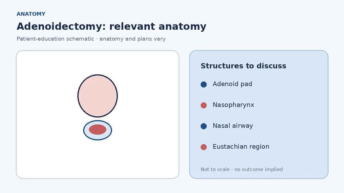 Medical illustration of adenoid tissue in the nasopharynx behind the nasal cavity