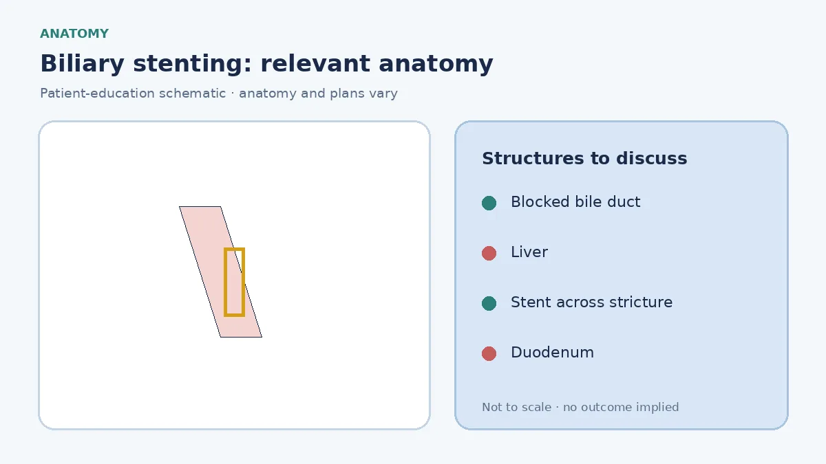 Medical illustration of a narrowed bile duct causing backup of bile toward the liver