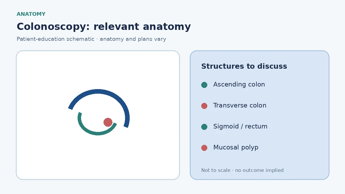 Medical illustration of the colon and rectum showing a polyp on the mucosal lining