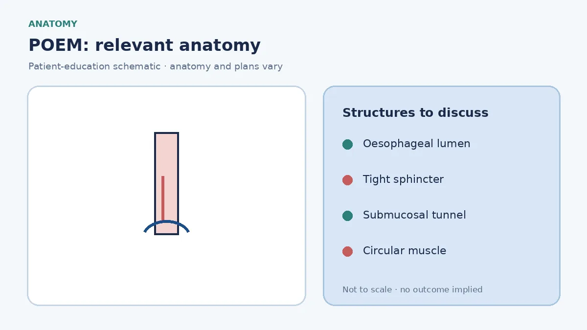 Medical illustration of a tight lower oesophageal sphincter typical of achalasia