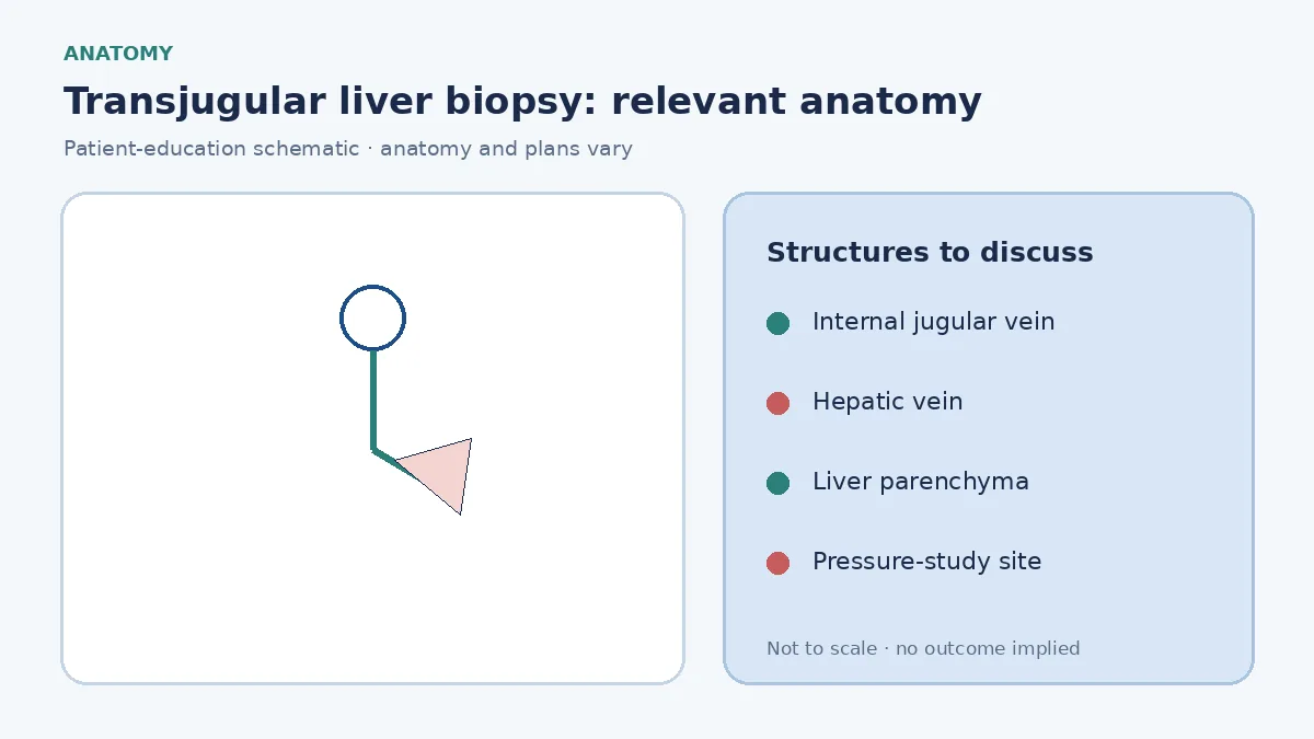 Medical illustration of jugular access leading through the heart toward a hepatic vein