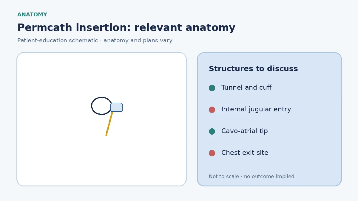 Medical infographic of a tunnelled cuffed permcath from a chest exit site into the central veins for hemodialysis