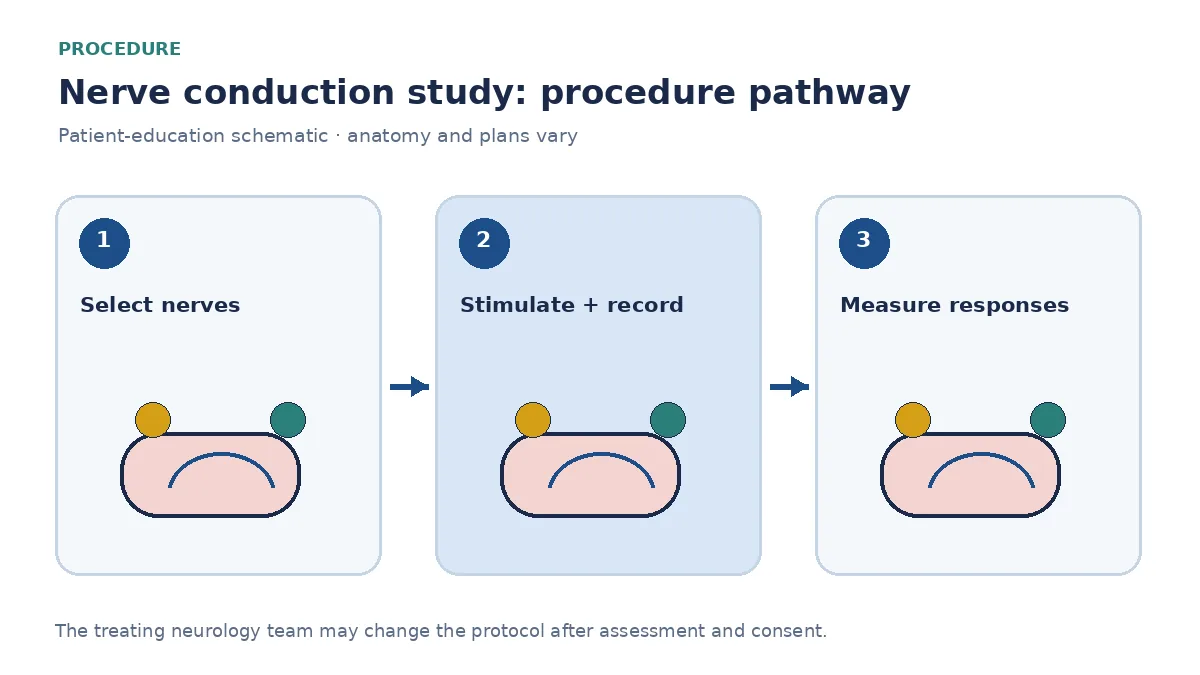 Numbered nerve conduction pathway showing electrode placement, brief stimulation and response interpretation