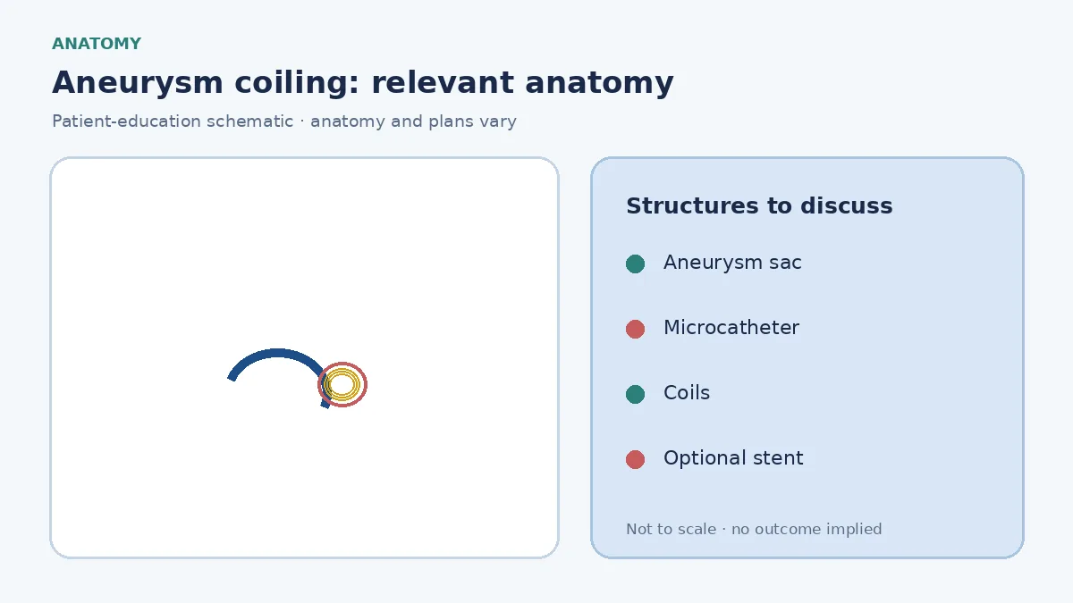 Medical illustration of an intracranial aneurysm being approached by a microcatheter from the arterial tree