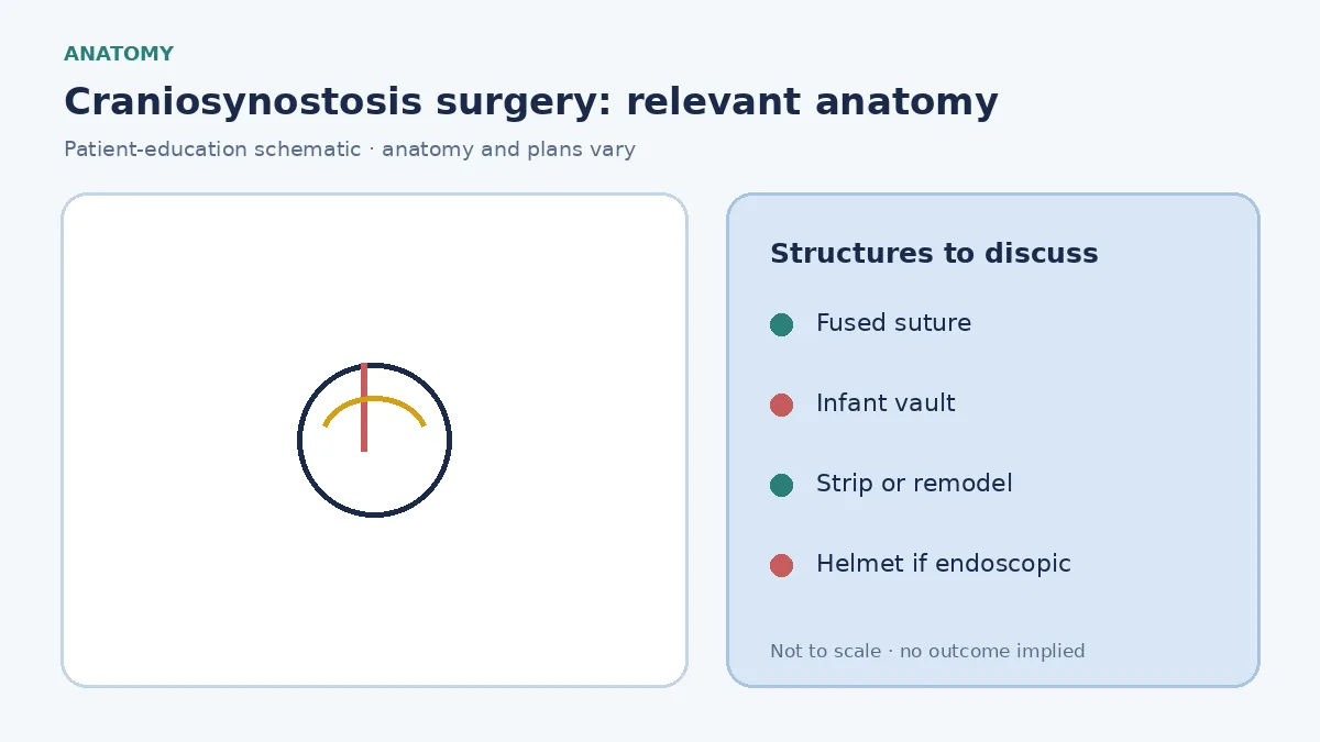 Medical illustration of an infant skull with a fused cranial suture causing compensatory head-shape change