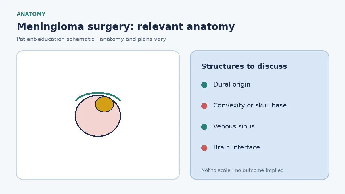 Medical illustration of a meningioma arising from the dura along the convexity or skull base