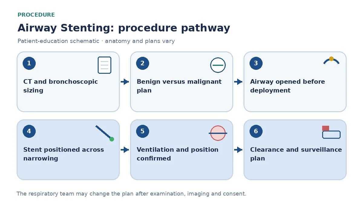Airway-stenting pathway showing CT sizing, benign-versus-malignant review, rigid airway opening, selected device deployment, position and ventilation confirmation, then clearance and surveillance planning