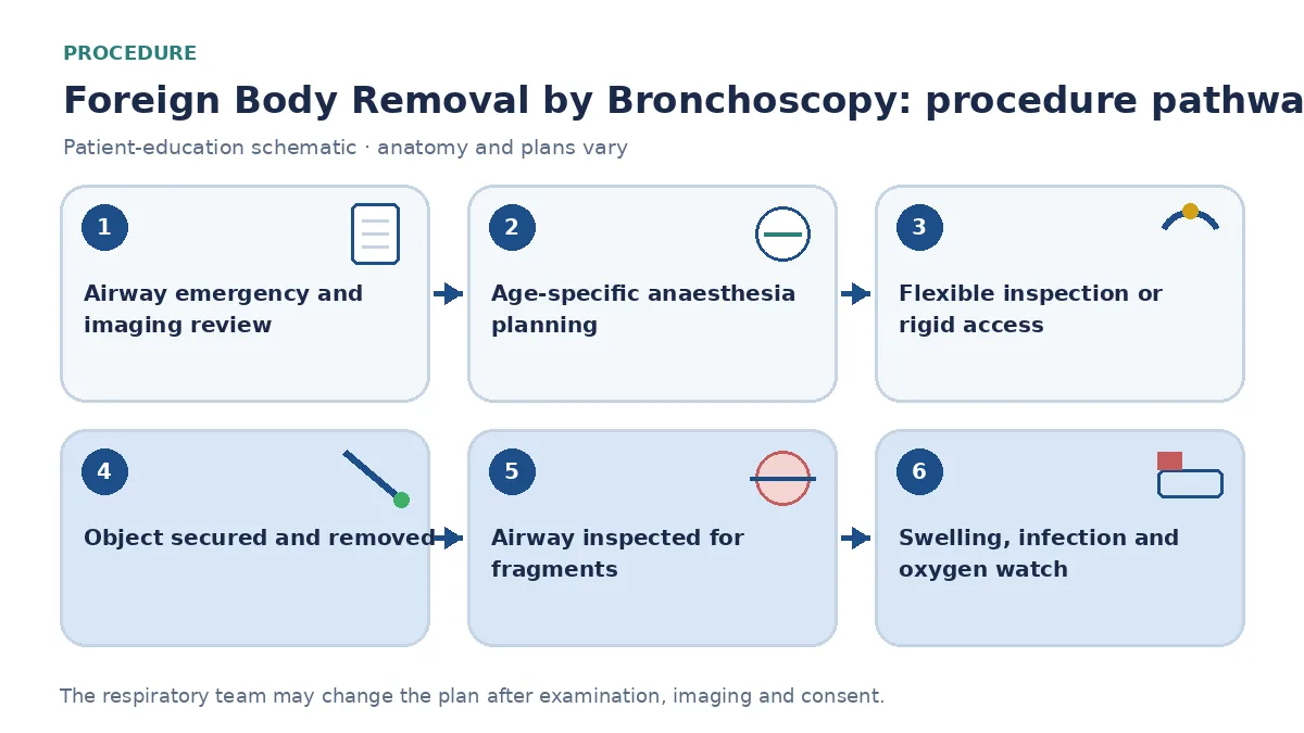 Foreign-body-removal pathway showing emergency assessment and imaging, age-specific anaesthesia, flexible inspection or rigid access, controlled extraction, bilateral fragment check and swelling or infection monitoring