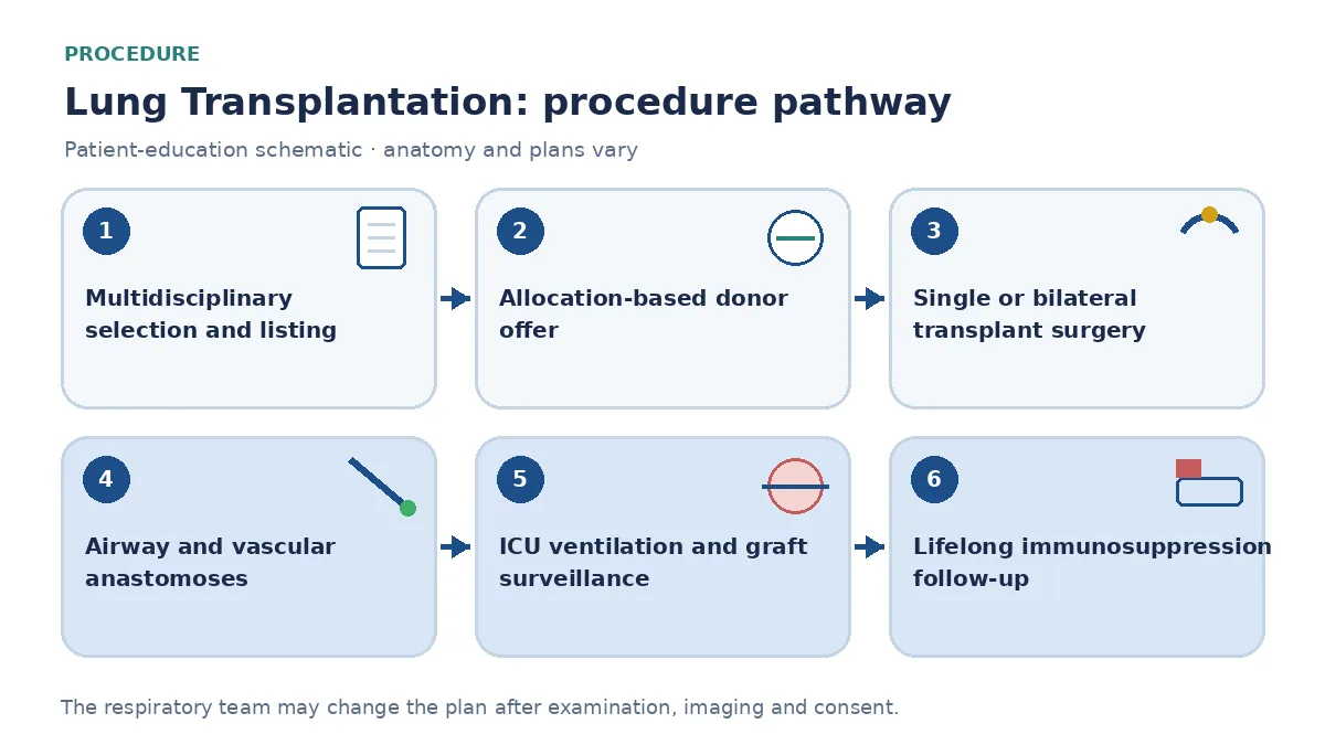 Lung-transplant pathway showing multidisciplinary selection and lawful listing, allocation-based donor offer, single or bilateral surgery, airway and vascular connections, ICU graft surveillance and rehabilitation