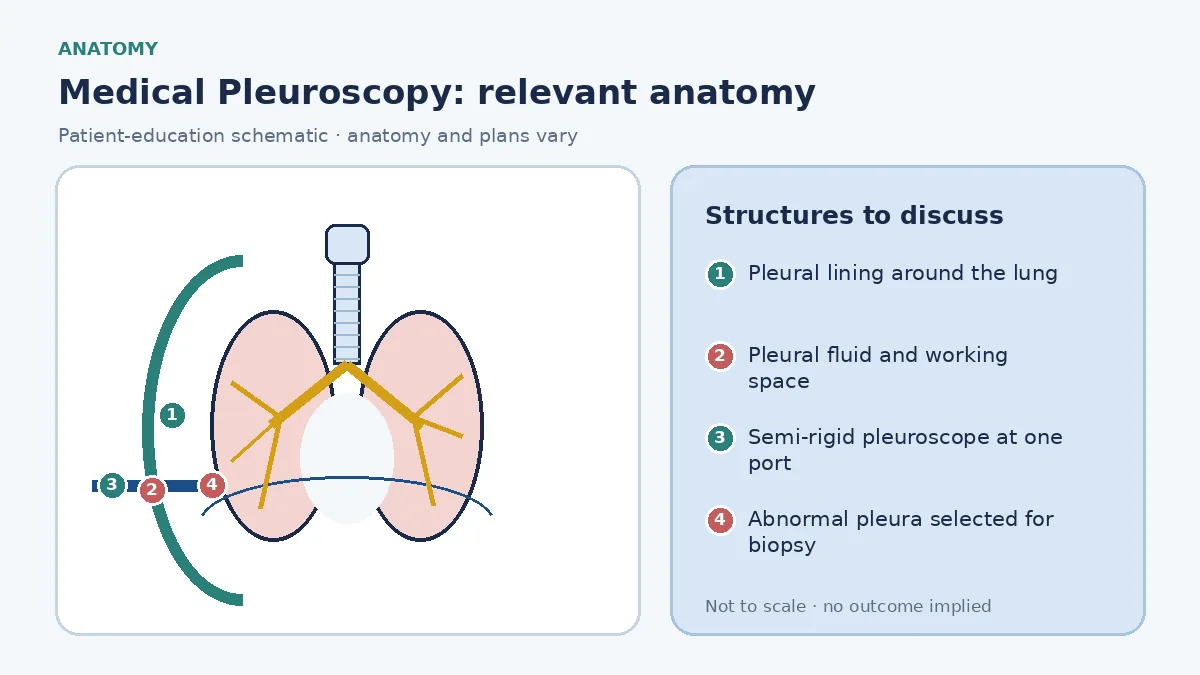 Educational pleuroscopy schematic showing the lung and layered pleura, fluid-created working space, a semi-rigid scope through one ultrasound-planned chest-wall port and targeted abnormal parietal pleura