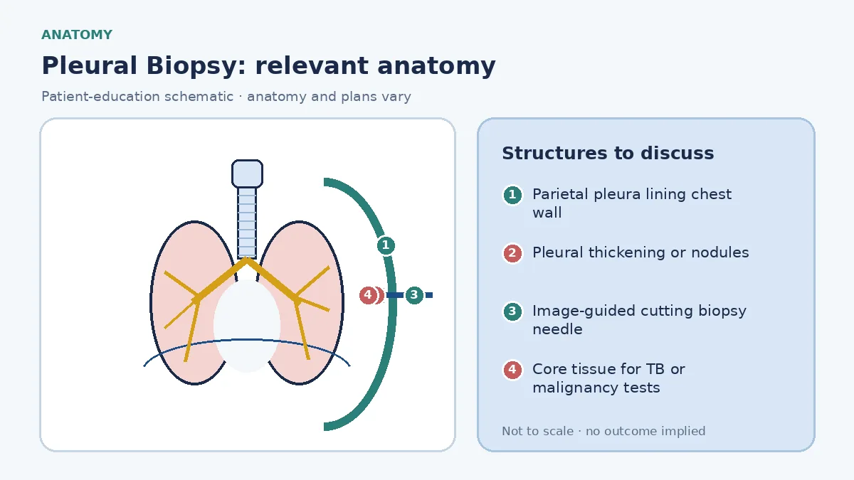 Educational pleural schematic showing parietal pleural thickening between chest wall and lung, an image-guided cutting needle entering above a rib, a core target and nearby pleural air-risk space
