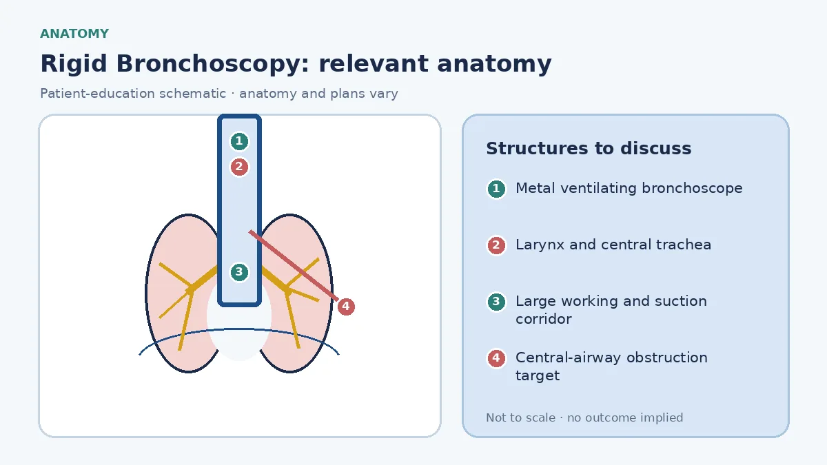 Educational central-airway schematic showing a straight metal ventilating rigid bronchoscope crossing the larynx into the trachea, its broad suction and instrument lumen, and a central obstruction target