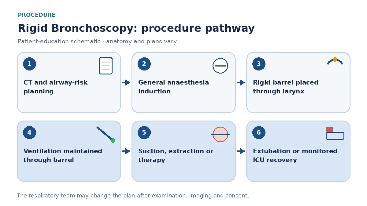 Rigid bronchoscopy pathway showing CT airway-risk review, general anaesthesia, barrel placement, ventilation through the tube, selected extraction or intervention, haemostasis and monitored extubation