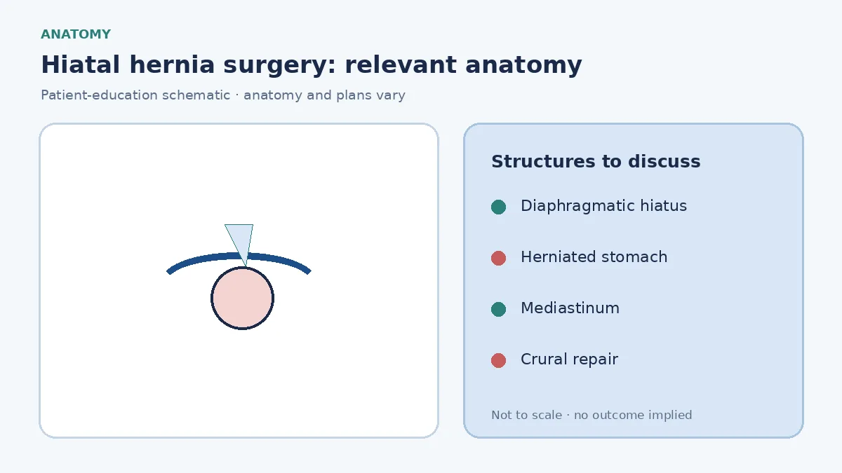 Medical illustration of a hiatal hernia with stomach migrating through the diaphragmatic hiatus into the chest