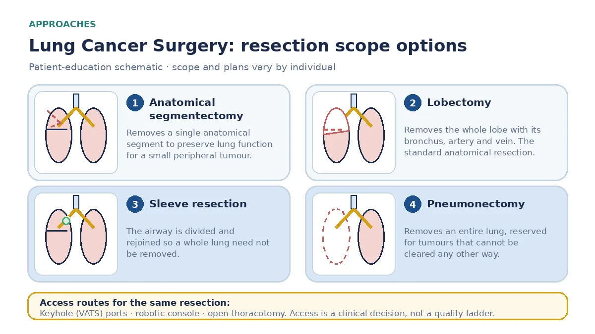 Medical infographic comparing anatomical segmentectomy, lobectomy, sleeve resection reconstructing the airway to avoid removing a whole lung, and pneumonectomy, alongside keyhole, robotic and open access routes.