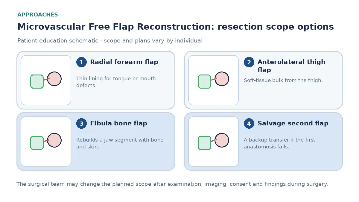 Medical infographic comparing radial forearm, anterolateral thigh and fibula bone flaps, two-team operating, and a salvage second flap if the first anastomosis fails.