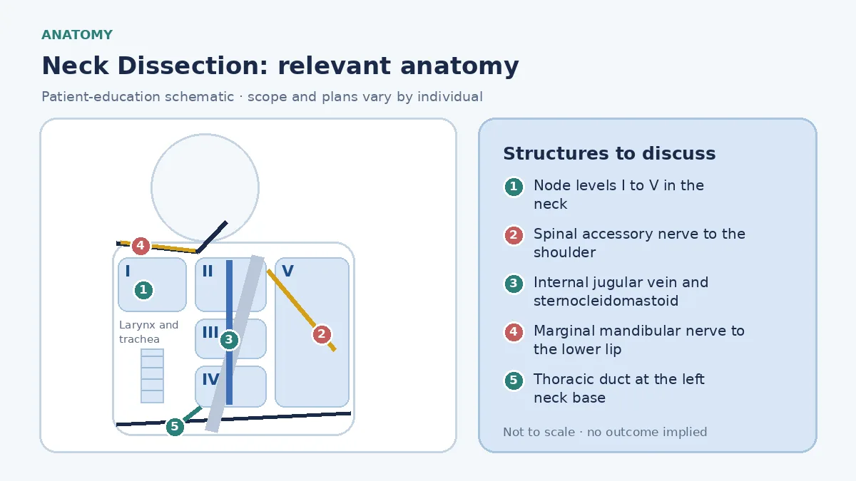 Medical illustration of neck lymph node levels one to five for dissection planning, marking the spinal accessory nerve, internal jugular vein, marginal mandibular nerve and thoracic duct as structures preserved where disease allows.