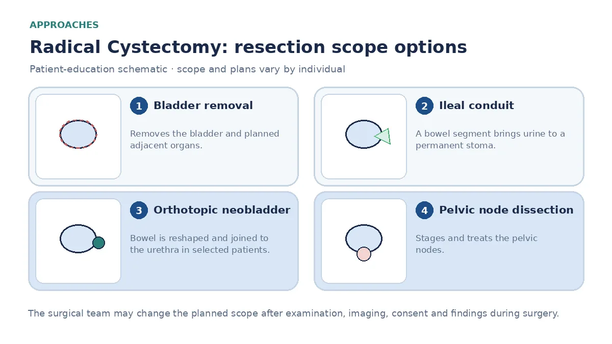 Medical infographic comparing ileal conduit with an abdominal stoma, orthotopic neobladder joined to the urethra, pelvic node dissection, and open versus robotic cystectomy access.