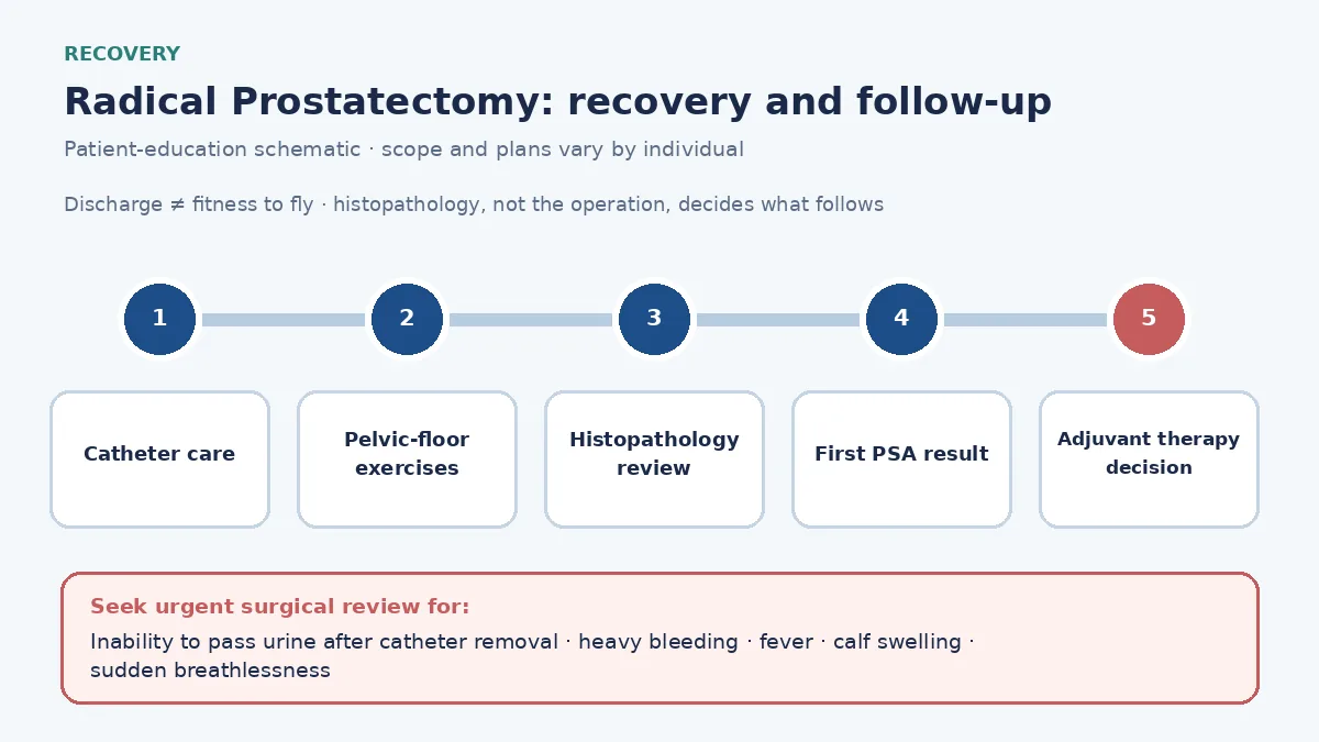 Medical infographic of the radical prostatectomy recovery pathway: catheter care, pelvic-floor exercises, histopathology, the first PSA, and the adjuvant radiation or systemic-therapy decision.