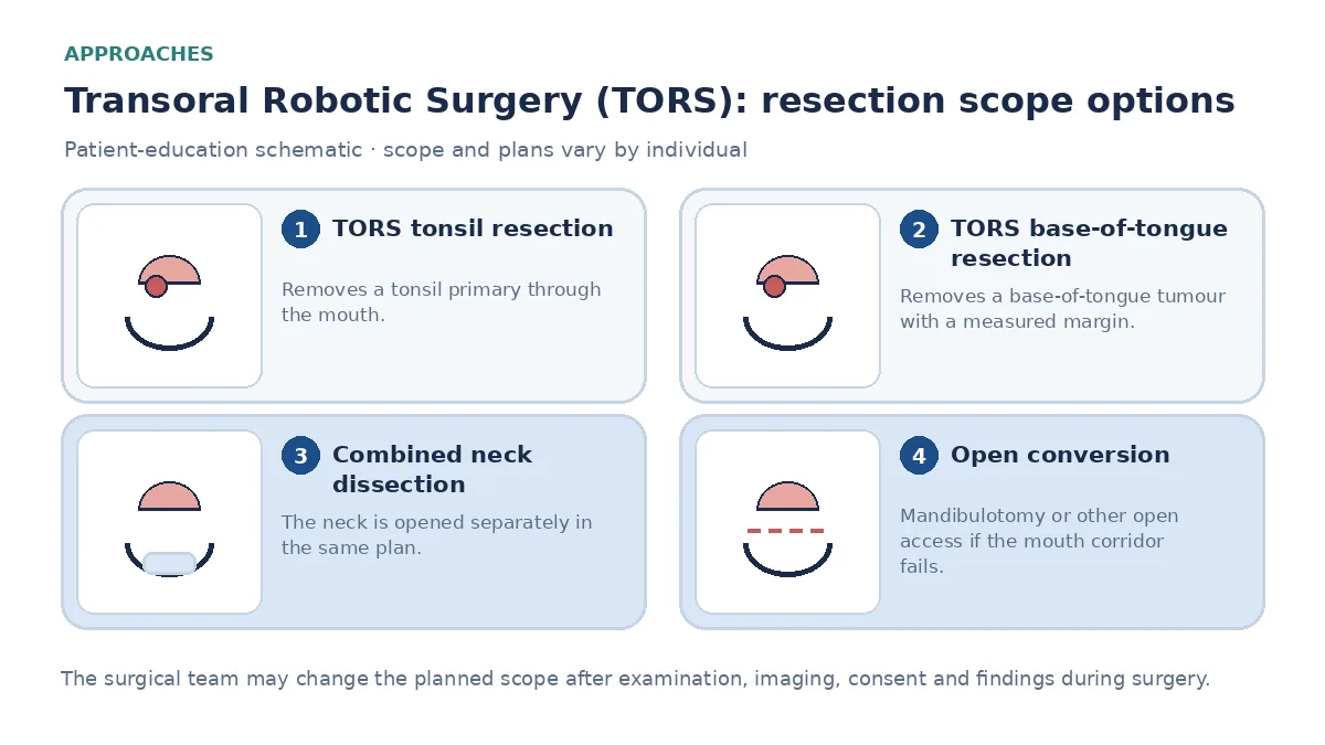 Medical infographic comparing TORS tonsil resection, TORS base-of-tongue resection, combined ipsilateral neck dissection, and open conversion with mandibulotomy when the mouth corridor is insufficient.