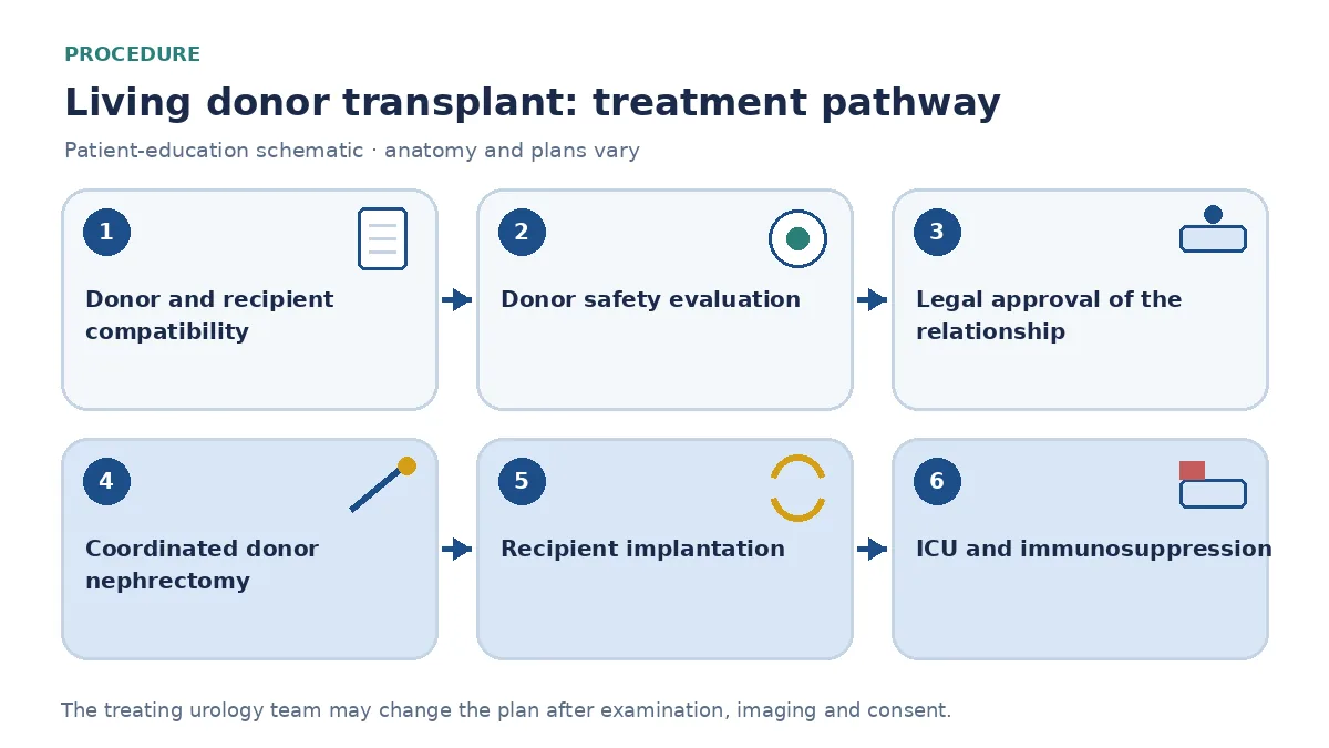 Step-by-step living donor transplantation pathway infographic showing donor and recipient compatibility testing, legal approval, coordinated donor nephrectomy and recipient implantation, ICU monitoring and immunosuppression start