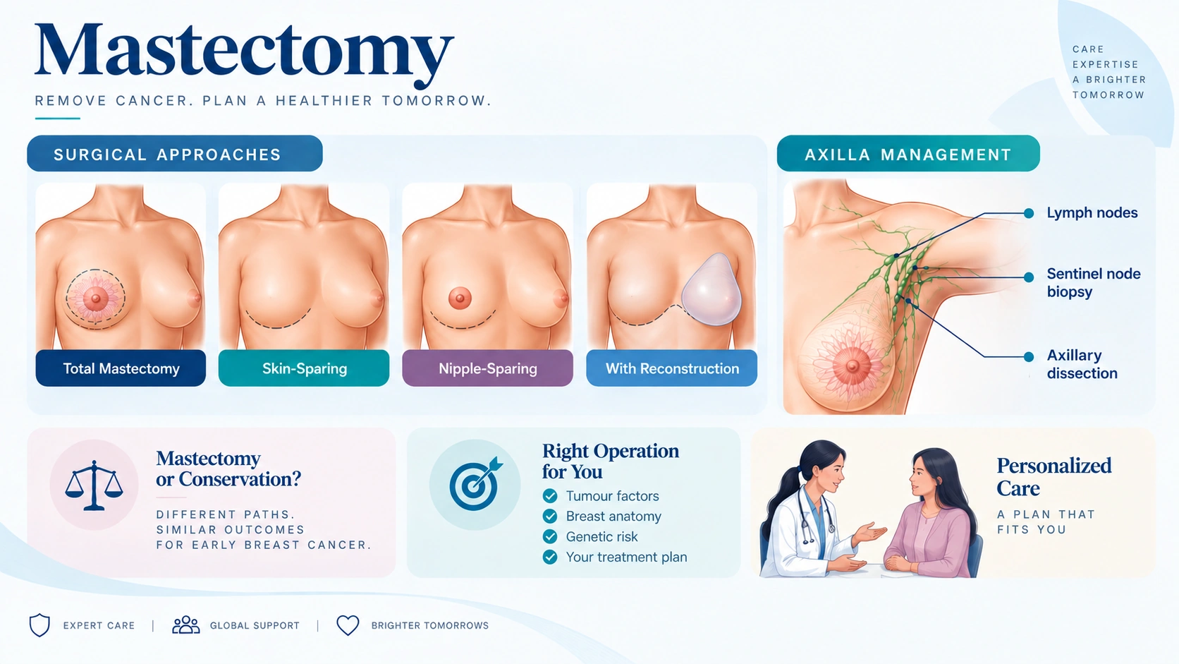 Mastectomy overview infographic showing four surgical approaches — total mastectomy, skin-sparing mastectomy, nipple-sparing mastectomy, and mastectomy with reconstruction — plus axilla management with lymph nodes, sentinel node biopsy and axillary dissection. Notes that mastectomy and breast conservation can have similar outcomes in early breast cancer, and that the right operation depends on tumour factors, breast anatomy, genetic risk and the individual treatment plan.