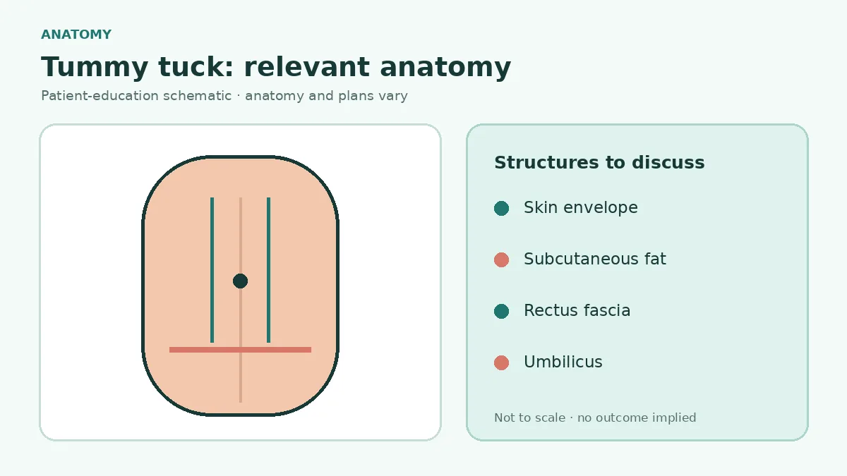 Medical illustration of abdominal skin, subcutaneous fat, rectus muscles, fascia and umbilicus relevant to tummy tuck planning