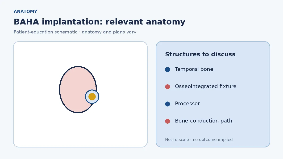 Medical illustration of skull bone behind the ear transmitting vibration toward the cochlea