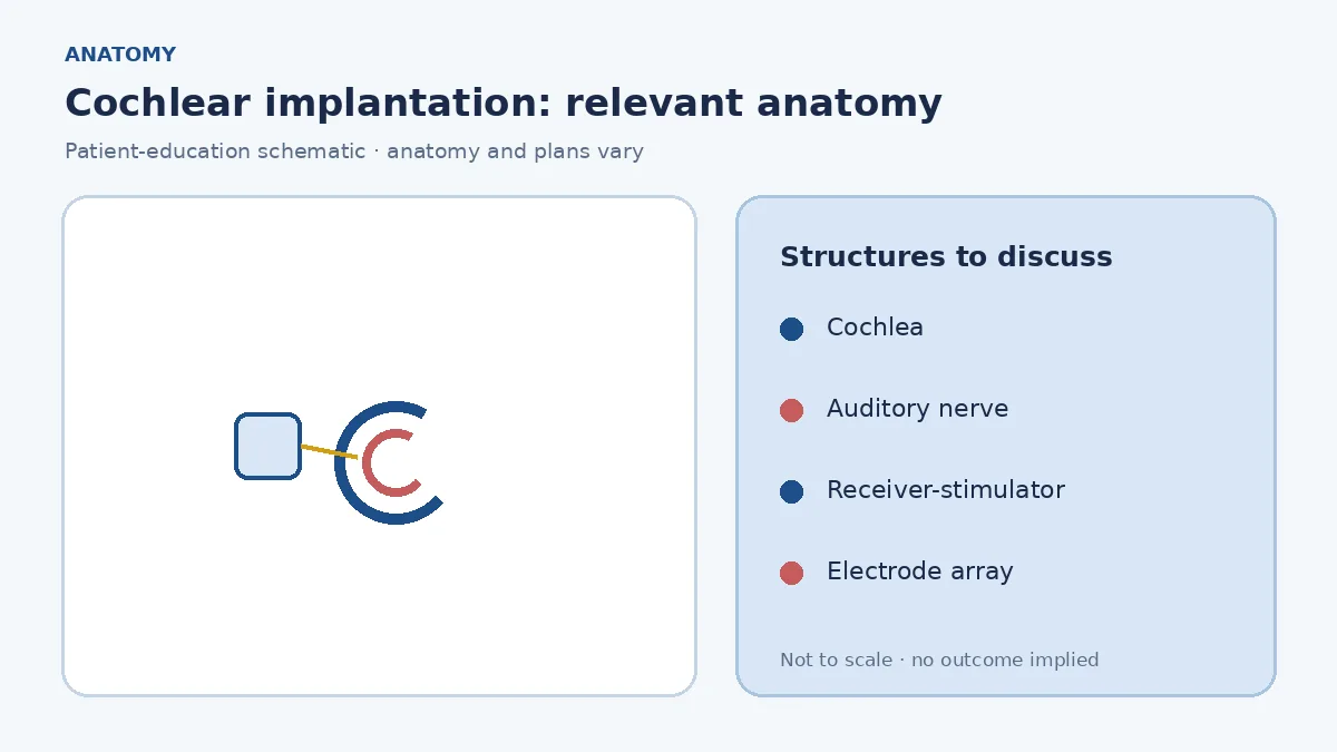 Medical illustration of the cochlea and auditory nerve showing where an electrode array is intended to sit