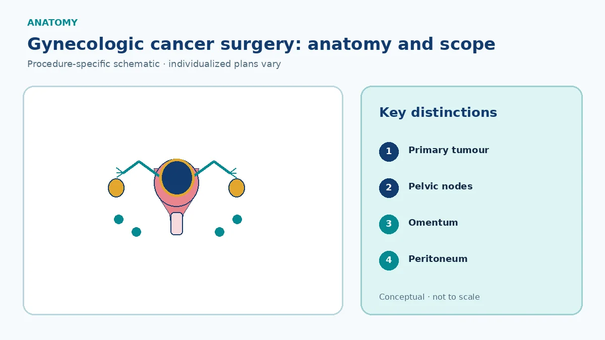 Patient-education gynecologic oncology schematic showing uterus cervix ovaries peritoneum omentum and pelvic lymph nodes as distinct staging sites
