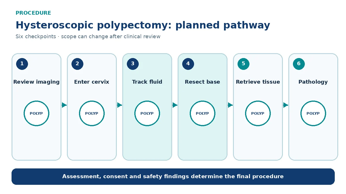 Numbered hysteroscopic polypectomy pathway showing imaging, cervical entry, fluid distension, direct base resection, tissue retrieval and pathology