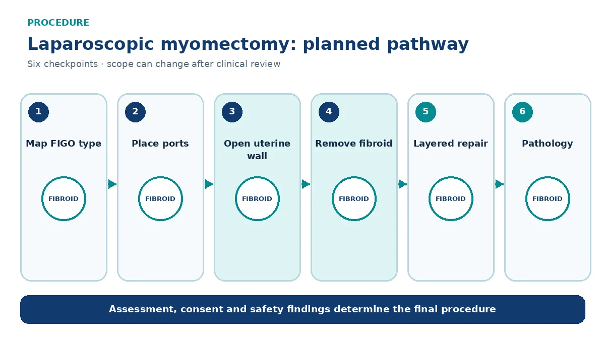 Numbered laparoscopic myomectomy pathway showing fibroid mapping, ports, uterine incision, enucleation, layered repair and pathology