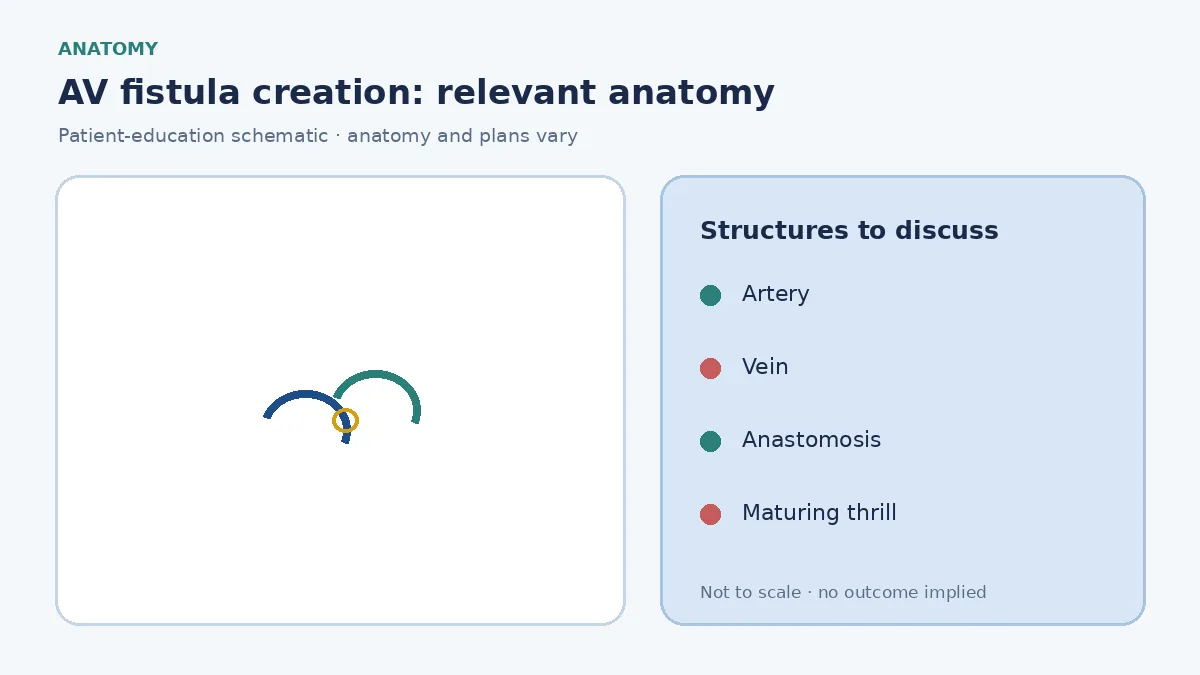 Medical infographic of an arteriovenous fistula showing an artery joined to a vein in the forearm for hemodialysis needles