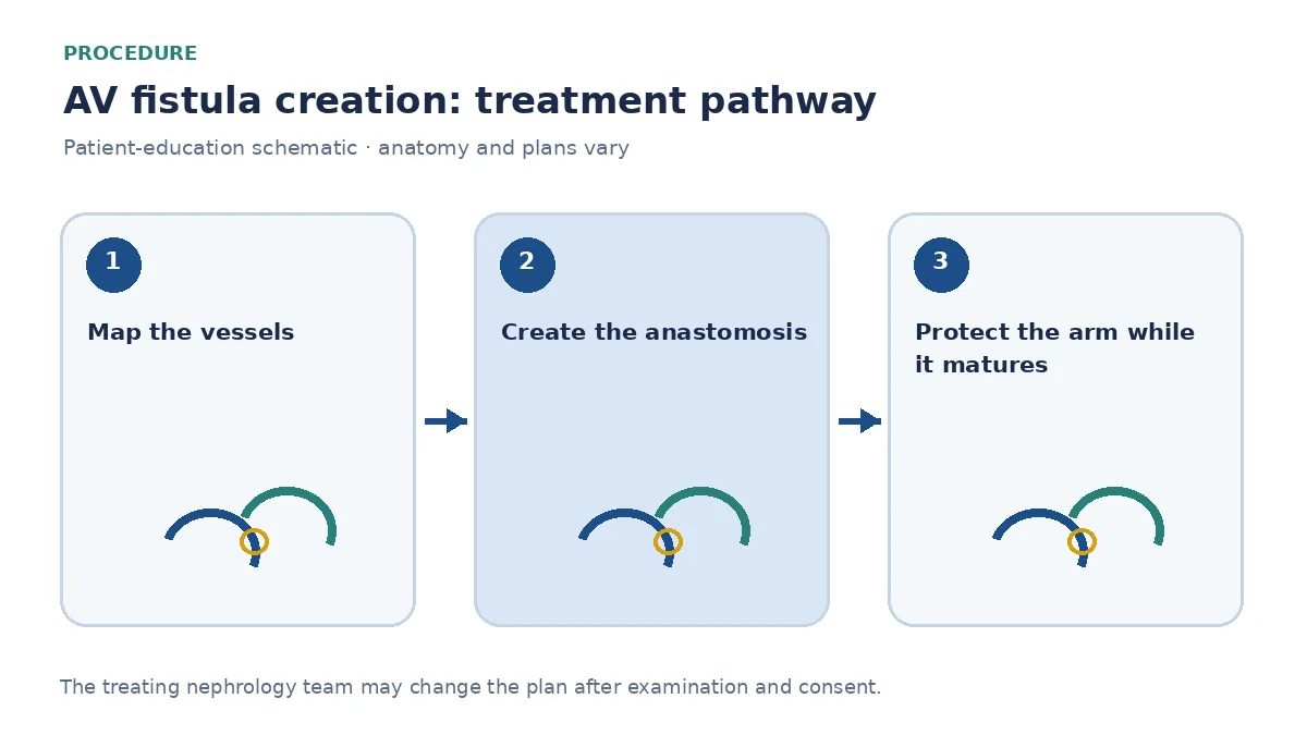 Step-by-step AV-fistula pathway showing vessel mapping, anastomosis and maturation checks before first needling