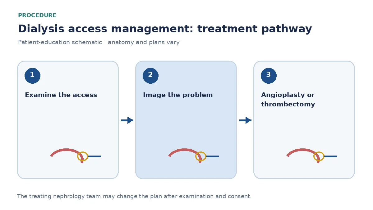 Step-by-step dialysis-access-management pathway showing examination, fistulogram and salvage intervention