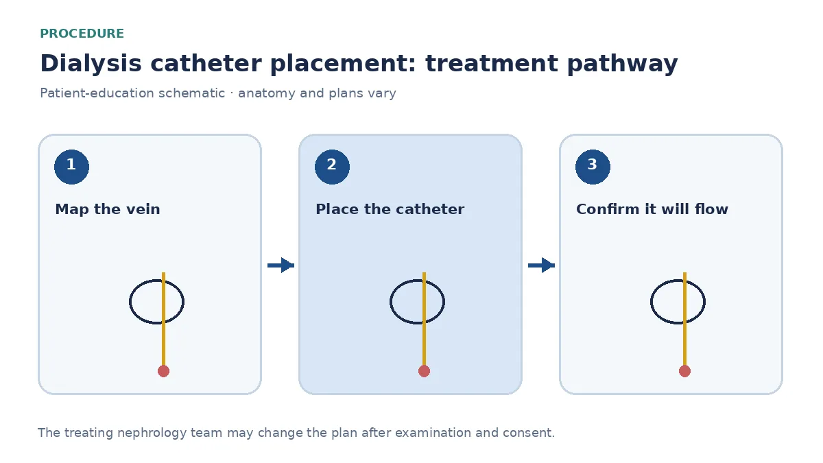 Step-by-step dialysis-catheter pathway showing vein mapping, ultrasound-guided insertion and first-use check
