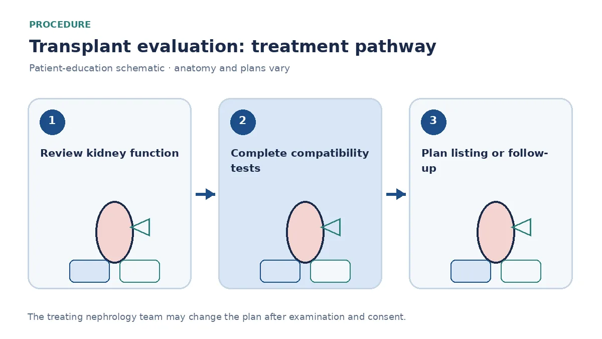Step-by-step transplant-evaluation pathway showing laboratories, HLA/crossmatch, listing discussion and later graft follow-up