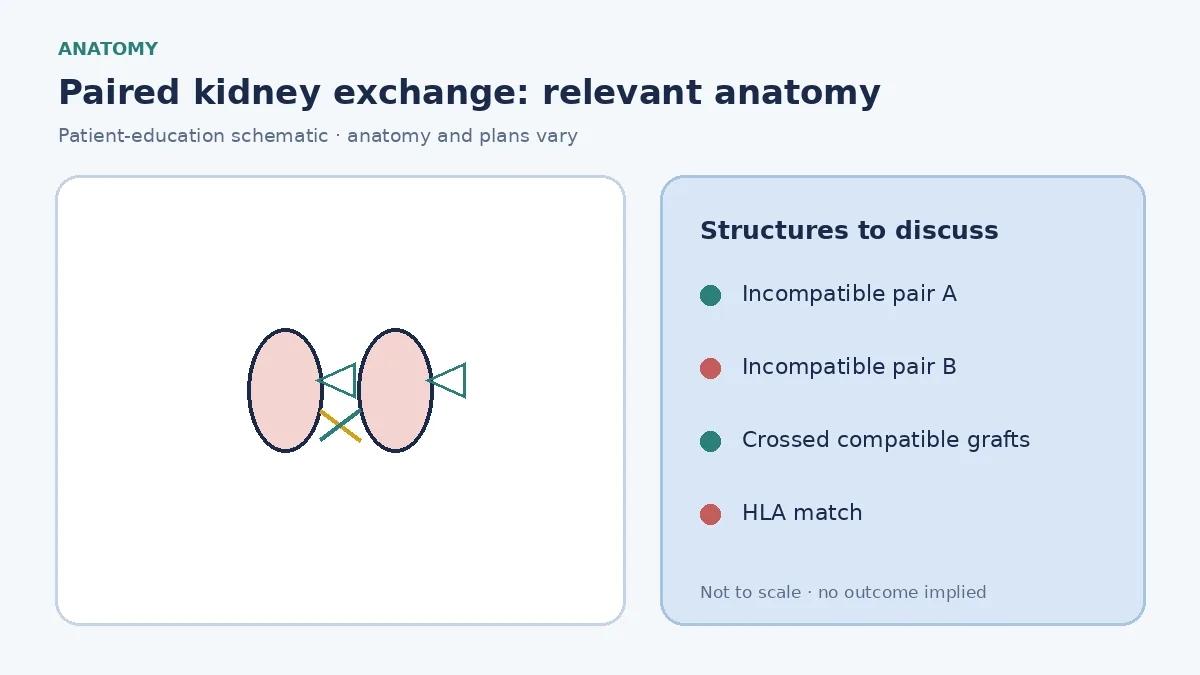 Medical infographic of paired kidney exchange showing two incompatible donor–recipient pairs crossing to compatible grafts
