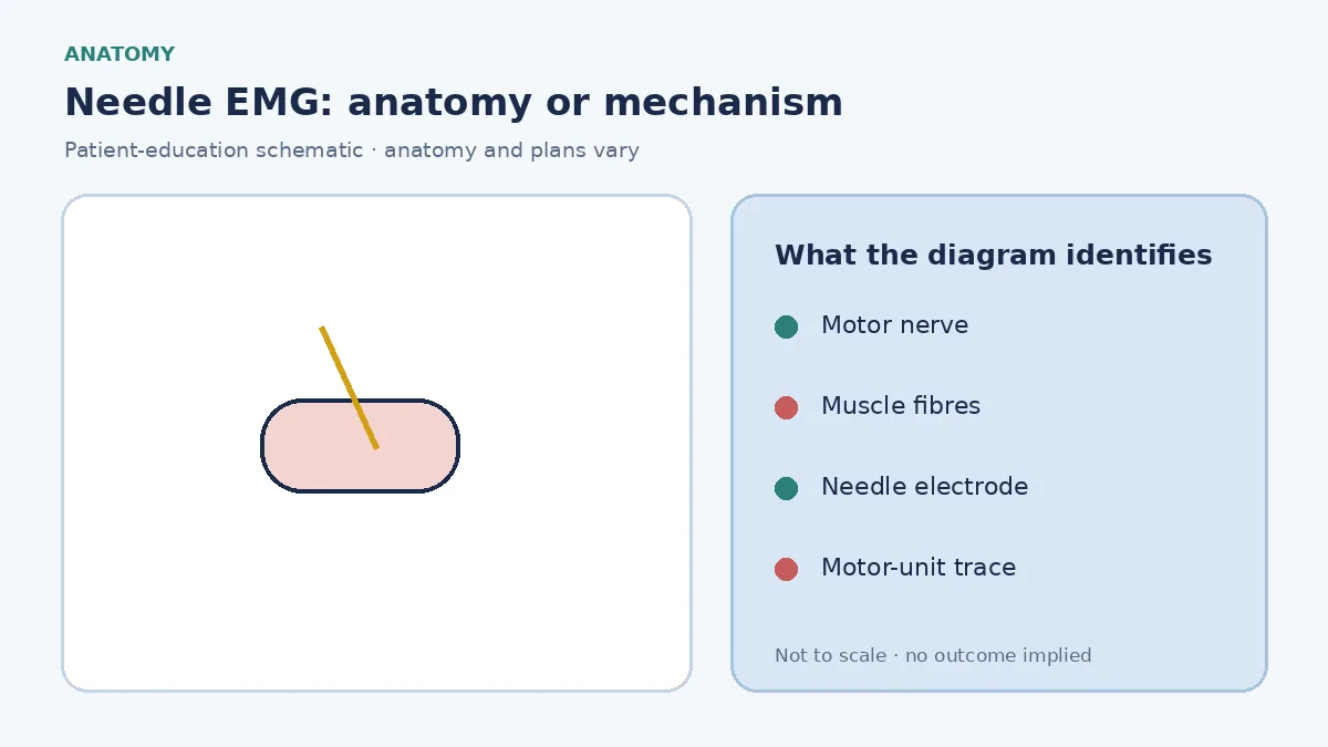Patient-education diagram showing a recording needle in selected muscle and motor-unit electrical activity