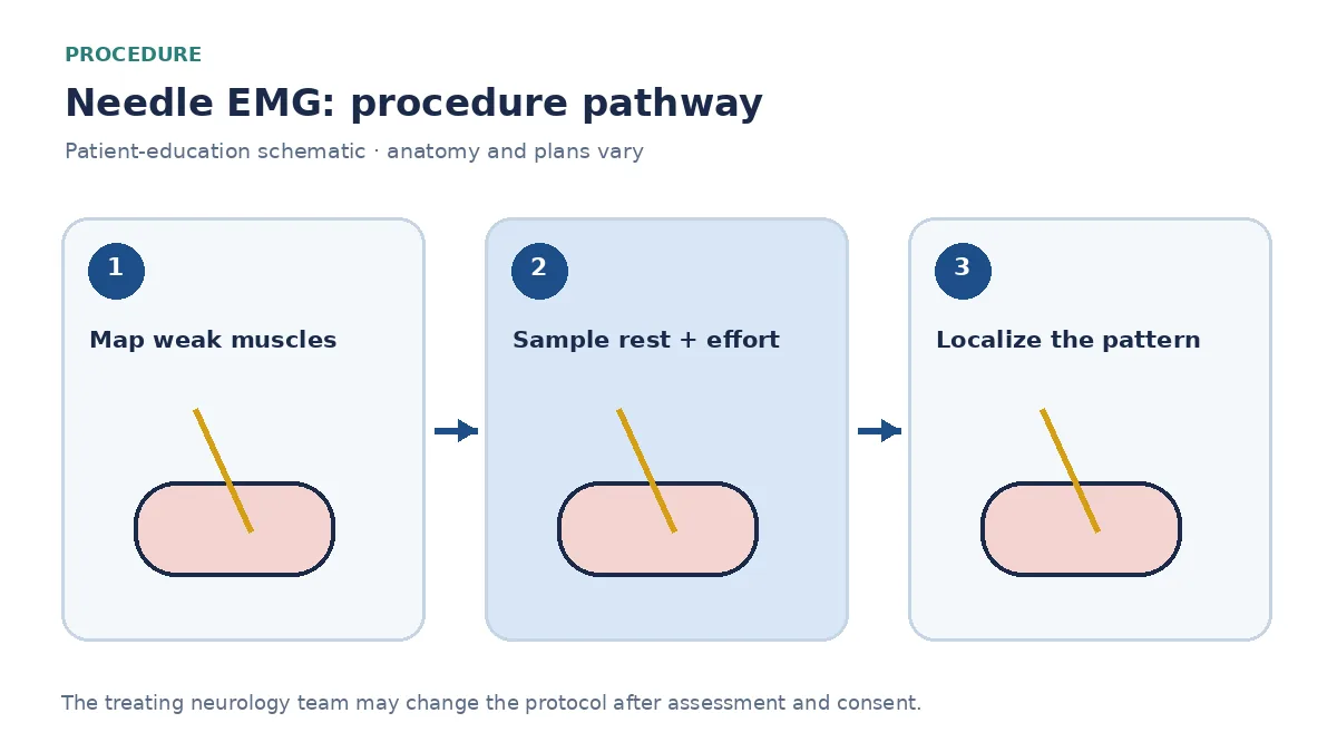 Numbered EMG pathway showing clinical mapping, muscle sampling at rest and activation, and interpretation