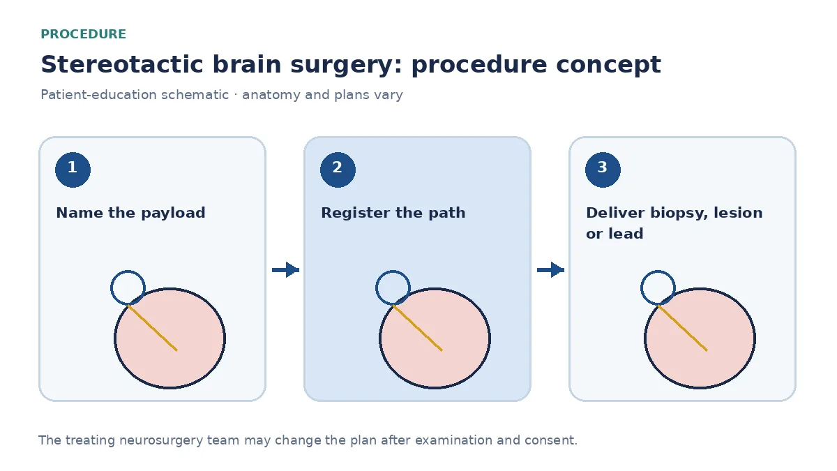 Clinical diagram of stereotactic brain surgery delivering a biopsy needle, lesion or lead along a planned path