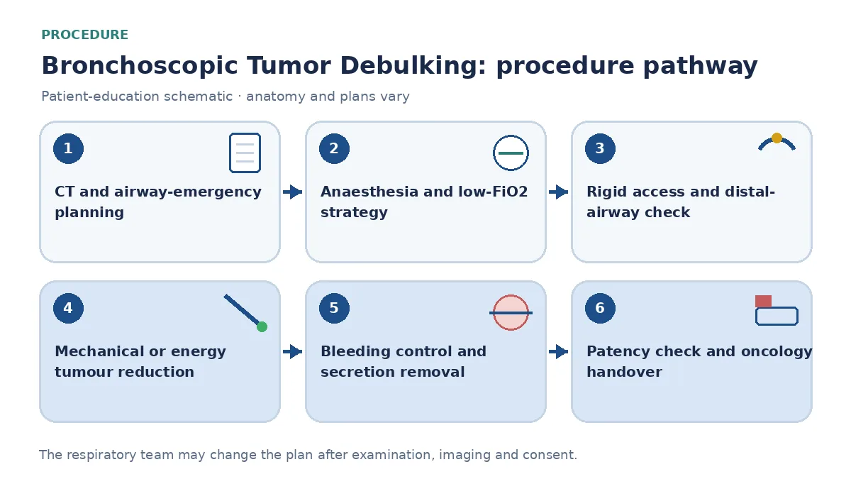 Tumour-debulking pathway showing contrast-CT rescue planning, general anaesthesia and low-FiO2 strategy, rigid access, controlled mechanical or energy reduction, bleeding control and oncology handover