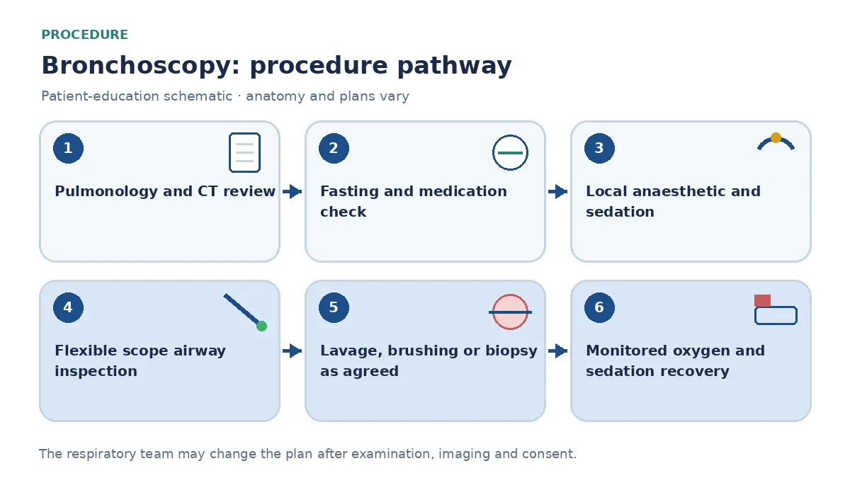 Step-by-step bronchoscopy pathway infographic showing pulmonology and CT review, fasting and medication check, local anaesthetic and sedation, flexible scope airway inspection, lavage or biopsy sampling and monitored recovery