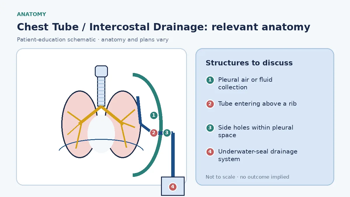 Educational pleural schematic showing air or fluid around a compressed lung, a chest tube entering above a rib with side holes inside the pleural space and tubing connected to an underwater-seal bottle