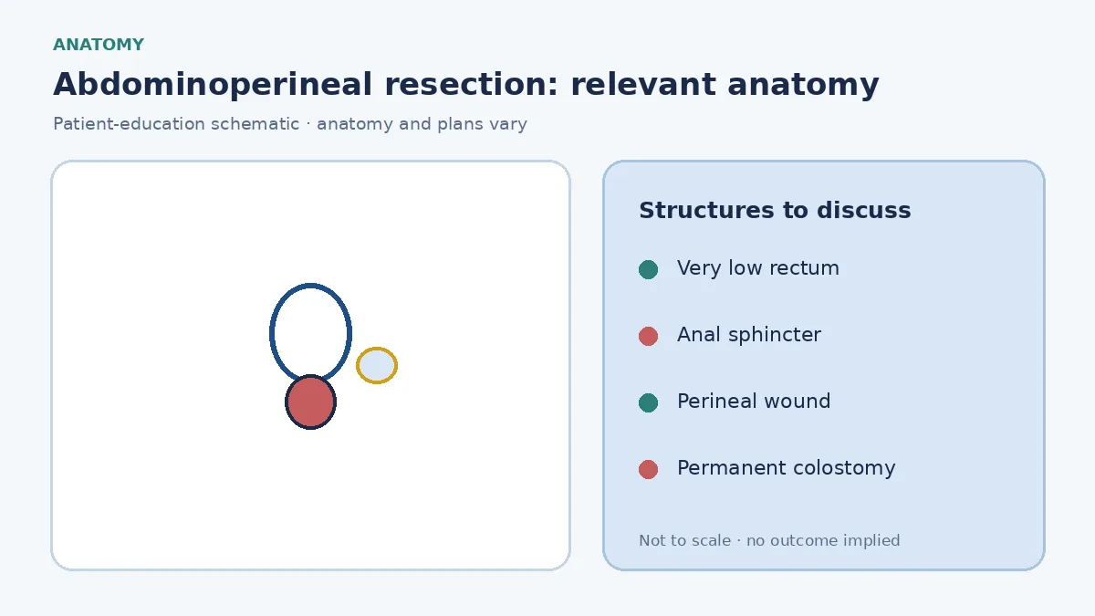 Medical illustration of a very low rectal tumour involving the anal sphincter, showing why APR may be considered