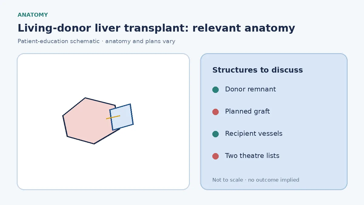 Medical illustration of living-donor liver anatomy showing a planned right or left graft and remnant liver