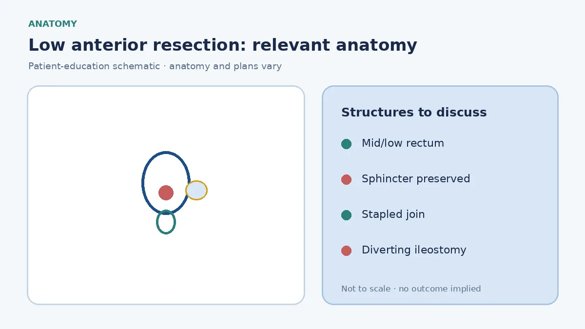 Medical illustration of the rectum and sphincter showing a mid or low tumour suitable for low anterior resection